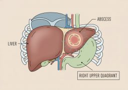 thumb-benh-ap-xe-gan