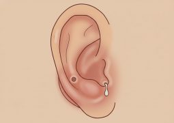 thumb-benh-ap-xe-ro-luan-nhi