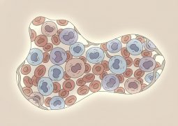 thumb-benh-bach-cau-cap-dong-tuy