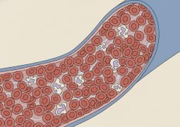 thumb-benh-bach-cau-giam