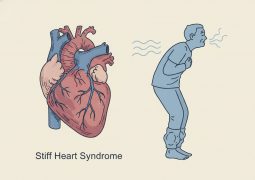 thumb-benh-co-tim-han-che